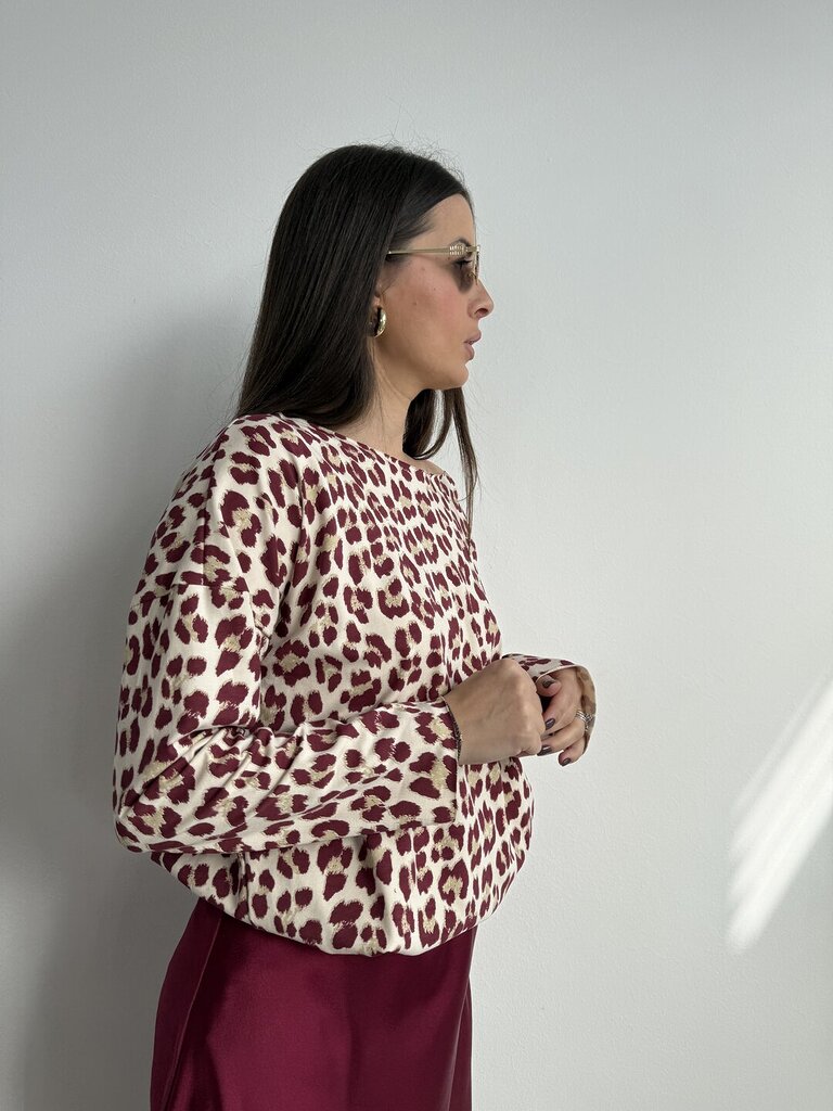 Ts Angela laser macula - Bordeaux 